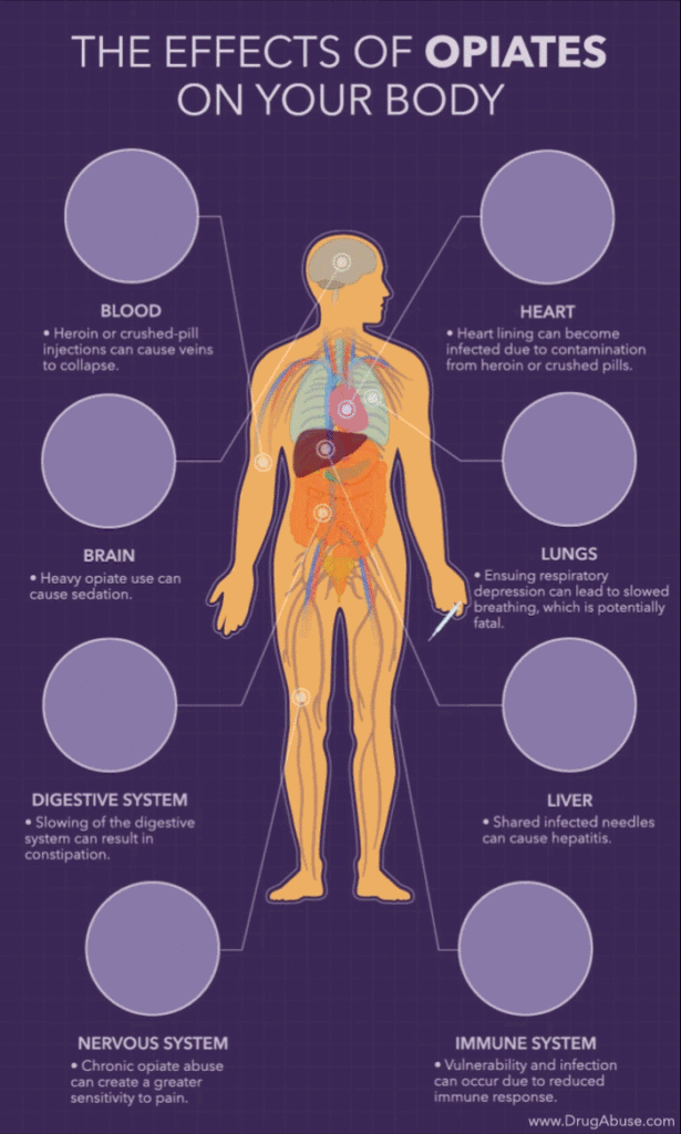 Effects of Heroin on the Body - Effects of Opiates on the Body